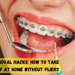 How to take braces off at home without pliers